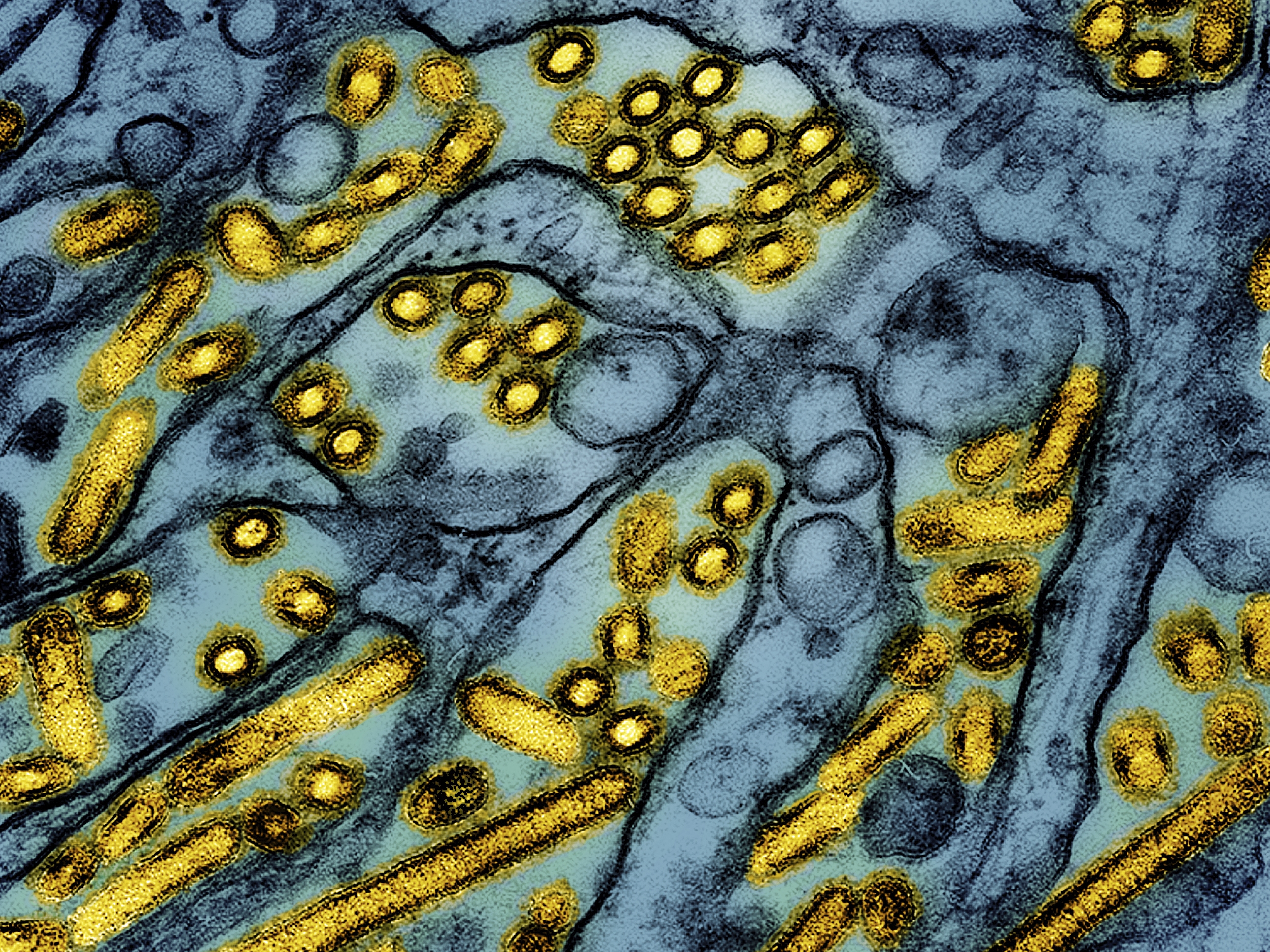 This colorized electron microscope image released by the National Institute of Allergy and Infectious Diseases in March shows avian influenza A H5N1 virus particles (in yellow). The CDC says the first severe case of bird flu detected in a human during the current U.S. outbreak.