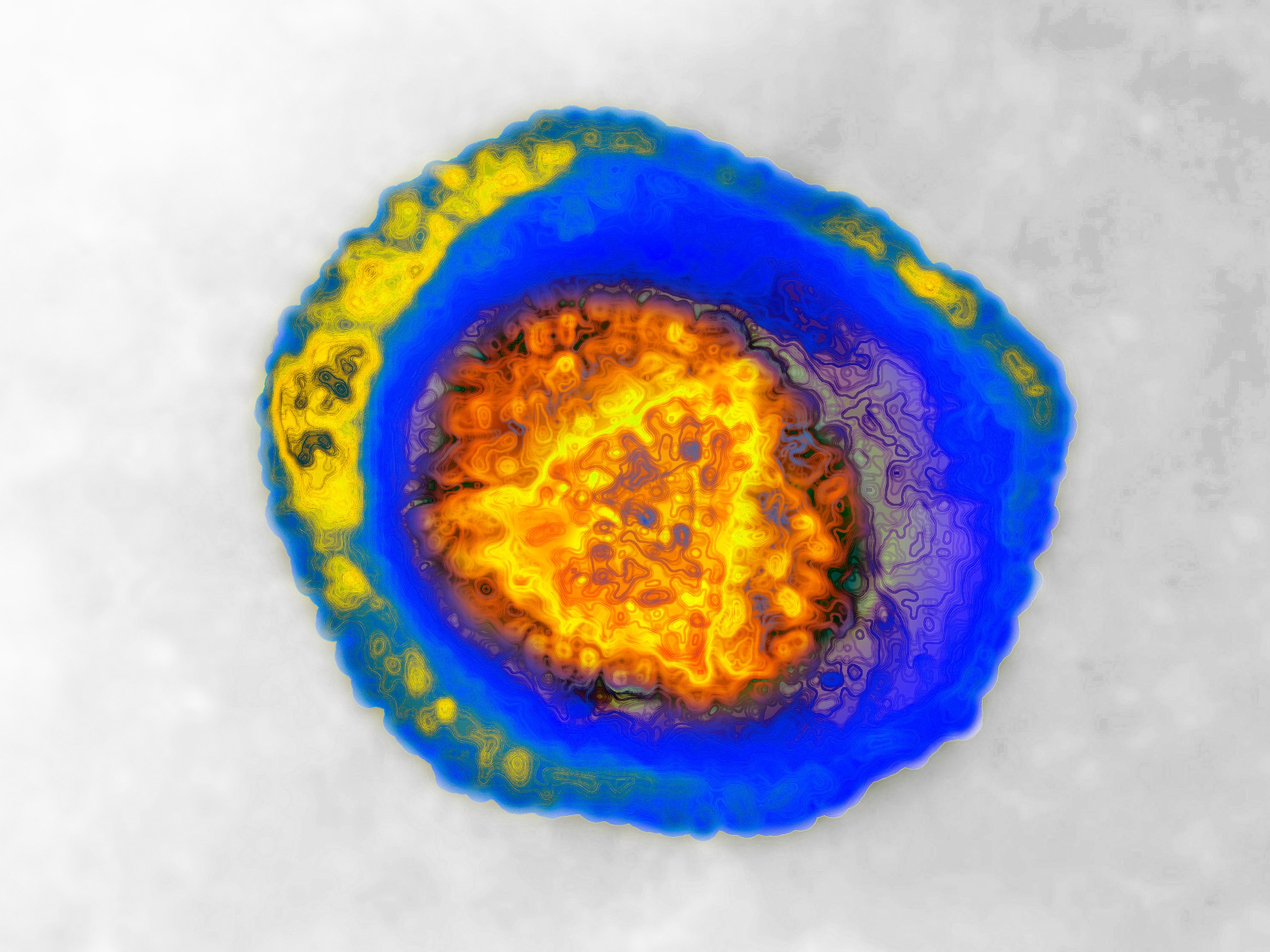 An image of the human herpes virus, HSV, taken with transmission electron microscope. Two types can cause genital herpes: HSV-1 and HSV-2.